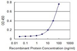 Novus Biologicals CYP4F3 Antibody (4E11), Novus Biologicals 0.1 mg, Unconjugated:Antibodies,