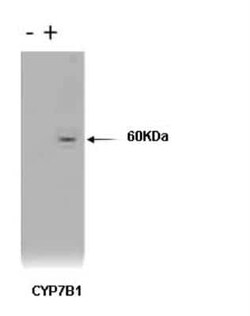 CYP7B1 Antibody (M17-P3F2) - BSA Free, Novus Biologicals:Antibodies:Primary