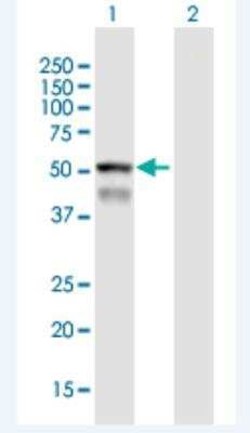 CYPIVF8 Antibody, Novus Biologicals 50 &mu;g | Buy Online | Novus Biologicals | Fisher Scientific