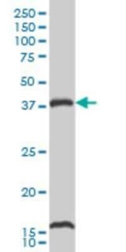 CaM Kinase I Antibody (2B6), Novus Biologicals 0.1 mg | Buy Online | Novus Biologicals | Fisher Scientific