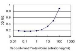 CaM Kinase II alpha Antibody (2C4), Novus Biologicals 0.1 mg | Buy Online | Novus Biologicals | Fisher Scientific