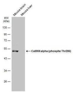 CaM Kinase II alpha, p Thr286 Antibody, Novus Biologicals 100 &mu;g | Buy Online | Novus Biologicals | Fisher Scientific