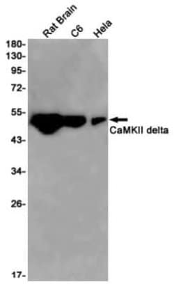CaM Kinase II delta Rabbit anti-Human, Mouse, Rat, Clone: S03-8A9, Novus