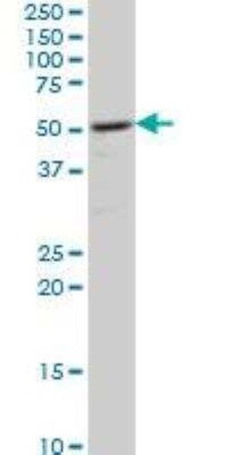 CaM Kinase II delta Antibody (1A8), Novus Biologicals 0.1 mg | Buy Online | Novus Biologicals | Fisher Scientific