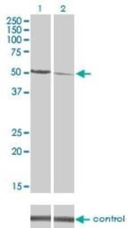 CaM Kinase II delta Antibody (1A8), Novus Biologicals 0.1 mg | Buy Online | Novus Biologicals | Fisher Scientific