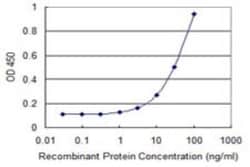 CaMKI gamma Antibody (3E2), Novus Biologicals 0.1 mg; Unconjugated:Anticorps,