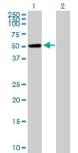 CaMKI gamma Antibody, Novus Biologicals 0.05 mg | Buy Online | Novus Biologicals | Fisher Scientific