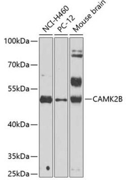 CaMKII beta Antibody - BSA Free, Novus Biologicals 0.02 mL, Unconjugated:Antibodies,