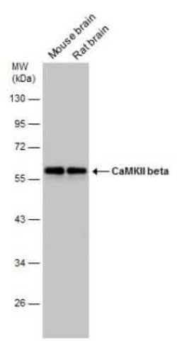 CaMKII beta Antibody, Novus Biologicals 100 &mu;g | Buy Online | Novus Biologicals | Fisher Scientific