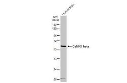 CaMKII beta Antibody, Novus Biologicals 100 &mu;g | Buy Online | Novus Biologicals | Fisher Scientific
