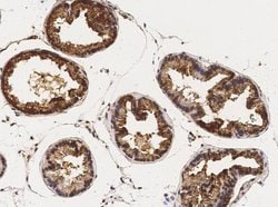 CaMKIV Rabbit anti-Mouse, Clone: 1, Novus Biologicals 50 &mu;g; Unconjugated:Antibodies,