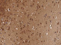 CaMKIV Rabbit anti-Mouse, Clone: 1, Novus Biologicals 50 &mu;g; Unconjugated:Antibodies,