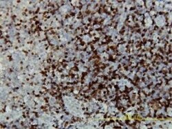 CaMKIV Antibody (1A3), Novus Biologicals 0.1 mg | Buy Online | Novus Biologicals | Fisher Scientific