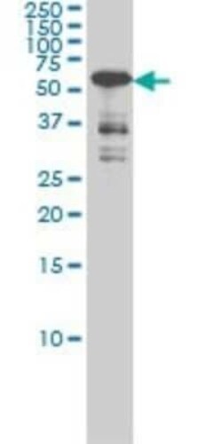 CaMKIV Antibody (1A3), Novus Biologicals 0.1 mg | Buy Online | Novus Biologicals | Fisher Scientific