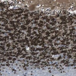 CaMKIV Antibody, Novus Biologicals 0.1 mL | Buy Online | Novus Biologicals | Fisher Scientific