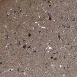 CaMKIV Antibody, Novus Biologicals 0.1 mL | Buy Online | Novus Biologicals | Fisher Scientific