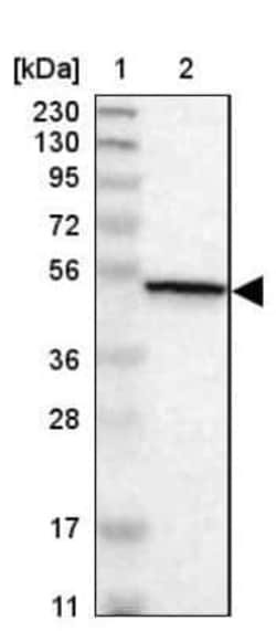 CaMKIV Antibody, Novus Biologicals 0.1 mL | Buy Online | Novus Biologicals | Fisher Scientific