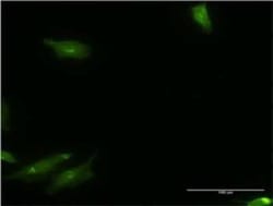 CaMKK alpha Antibody (4A11), Novus Biologicals 0.1 mg; Unconjugated:Antibodies,