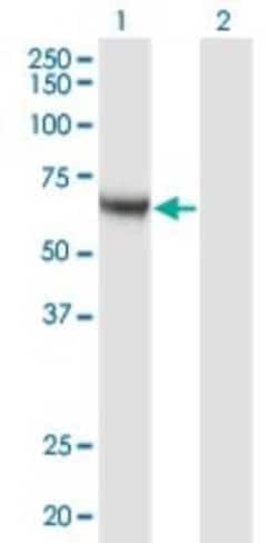 CaMKK alpha Antibody (4A11), Novus Biologicals 0.1 mg; Unconjugated:Antibodies,