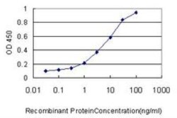 CaMKK2 Antibody (1A11), Novus Biologicals 0.1 mg | Buy Online | Novus Biologicals | Fisher Scientific