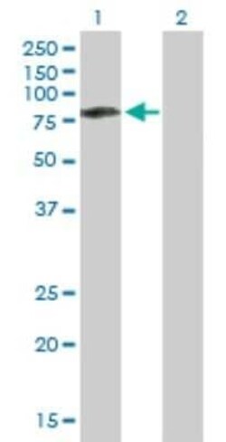 CaMKK2 Antibody, Novus Biologicals 0.05 mg | Buy Online | Novus Biologicals | Fisher Scientific