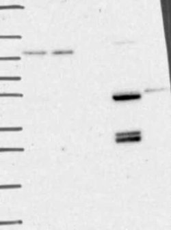 CaMKK2 Rabbit anti-Human, Polyclonal, Novus Biologicals 25 &mu;g; Unconjugated:Antibodies,