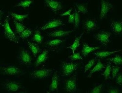 CaMKV Antibody, Novus Biologicals 50 &mu;g; Unconjugated:Antibodies, Polyclonal