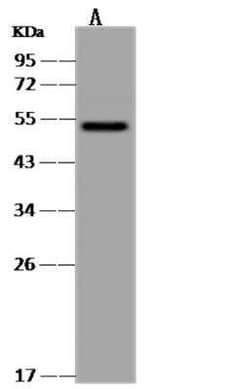 CaMKV Antibody, Novus Biologicals 50 &mu;g; Unconjugated:Antibodies, Polyclonal