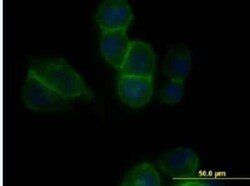 Cadherin-11 Antibody (3C8), Novus Biologicals 100 &mu;g | Buy Online | Novus Biologicals | Fisher Scientific