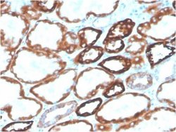 Cadherin-16 Antibody (CDH16/2125) - Azide and BSA Free, Novus Biologicals