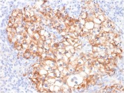 Cadherin-16 Antibody (CDH16/2125) - Azide and BSA Free, Novus Biologicals