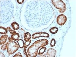 Cadherin-16 Antibody (CDH16/2125) - Azide and BSA Free, Novus Biologicals
