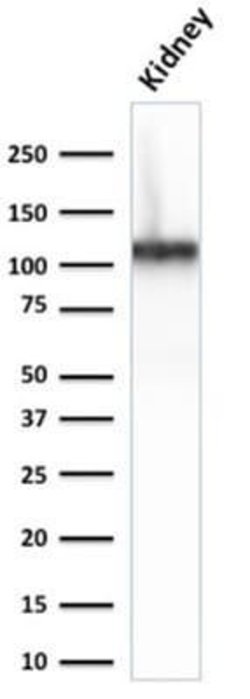 Cadherin-16 Antibody (CDH16/2125) - Azide and BSA Free, Novus Biologicals