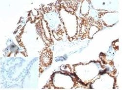 Cadherin-16 Rabbit anti-Human, Mouse, Rat, Clone: CDH16/7028R, Novus Biologicals:Antibodies:Primary