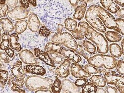 Cadherin-16 Antibody, Novus Biologicals:Antibodies:Primary Antibodies