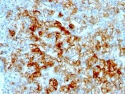Cadherin-16 Antibody (SPM594), Novus Biologicals:Antibodies:Primary Antibodies