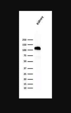 Cadherin-16 Antibody (SPM594), Novus Biologicals:Antibodies:Primary Antibodies