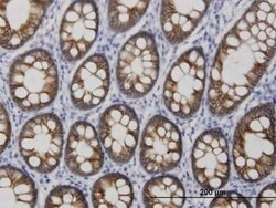 Cadherin-17 Antibody (3H2), Novus Biologicals 0.1 mg | Buy Online | Novus Biologicals | Fisher Scientific