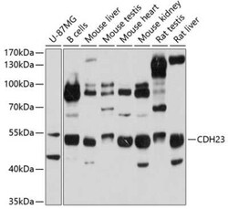 Cadherin-23 Antibody - BSA Free, Novus Biologicals 0.1 mL, Unconjugated:Antibodies,