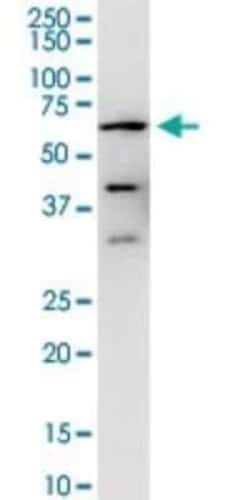 Calcineurin A Antibody (2G8), Novus Biologicals 0.1 mg | Buy Online | Novus Biologicals | Fisher Scientific