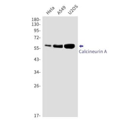 Calcineurin A Antibody (S01-6F5), Novus Biologicals 100 &mu;g; Unconjugated:Anticorps,