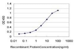 Calcineurin B Antibody (4E1), Novus Biologicals 0.1 mg | Buy Online | Novus Biologicals | Fisher Scientific