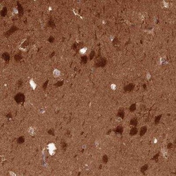 Calcineurin B Antibody, Novus Biologicals 0.1 mL, Unconjugated:Antibodies,