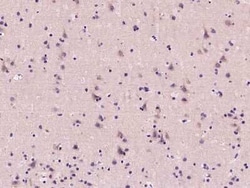 Calcineurin B Antibody, Novus Biologicals 100 &mu;g; Unconjugated:Antibodies,