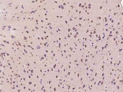 Calcineurin B Antibody, Novus Biologicals 100 &mu;g; Unconjugated:Antibodies,