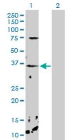 Calcium-binding-protein-P22 Antibody, Novus Biologicals 0.1 mg | Buy Online | Novus Biologicals | Fisher Scientific