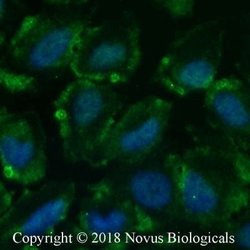 Calcium-sensing R/CaSR Antibody (HL 1499) - Azide and BSA Free, Novus Biologicals 0.1 mL | Buy Online | Novus Biologicals | Fisher Scientific