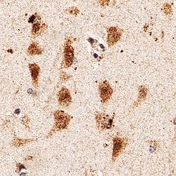 Calcium-sensing R/CaSR Antibody (HL 1499) - Azide and BSA Free, Novus Biologicals 0.1 mL | Buy Online | Novus Biologicals | Fisher Scientific