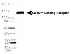 Calcium-sensing R/CaSR Antibody (HL 1499) - Azide and BSA Free, Novus Biologicals 0.1 mL | Buy Online | Novus Biologicals | Fisher Scientific