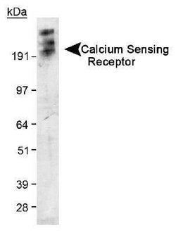 Calcium-sensing R/CaSR Antibody (HL 1499) - Azide and BSA Free, Novus Biologicals 0.1 mL | Buy Online | Novus Biologicals | Fisher Scientific